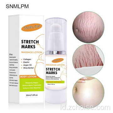 krim penghilang stretch mark penghilang kehamilan terbaik